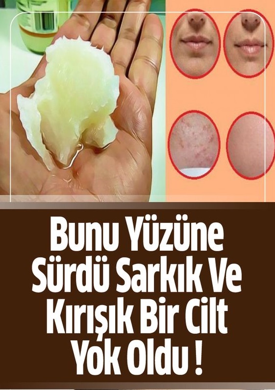 Bunu Yüzüne Sürdü Sarkık Ve Kırışık Bir Cilt Yok Oldu