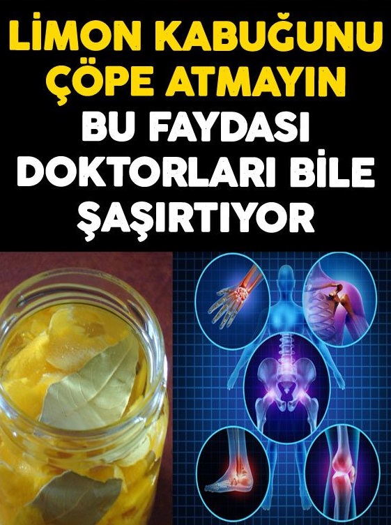 Eklem Ağrılarının Limon Kabuğuyla Tedavisi