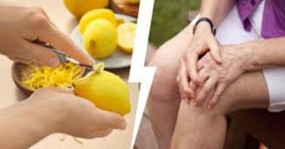 Eklem Ağrılarının Limon Kabuğuyla Tedavisi