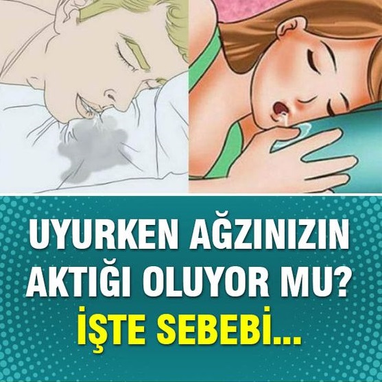 Uyurken Ağzınız Akıyor Mu? Hemen Okuyun