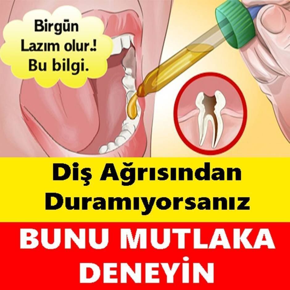 Diş ağrısından duramıyorsanız bunu denemelisiniz !!!