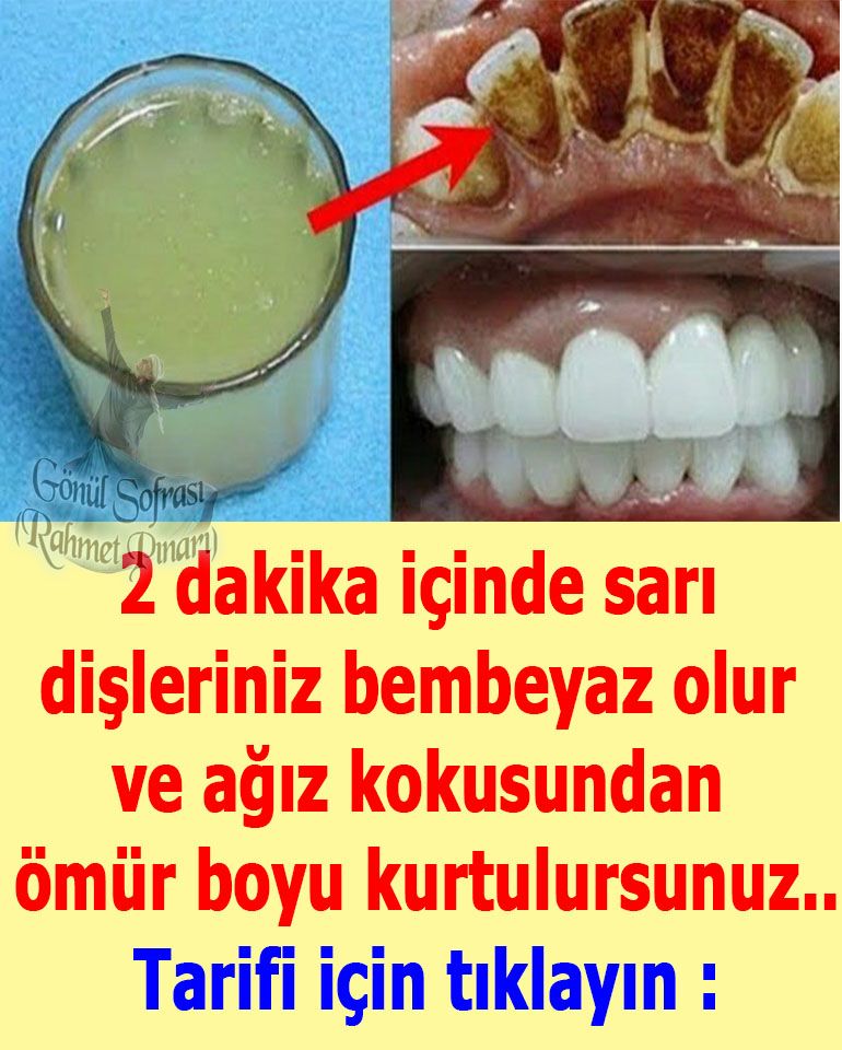2 dakika içinde sarı dişleriniz bembeyaz olur ve ağız kokusundan ömür boyu kurtulursunuz