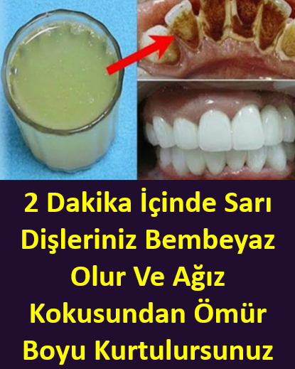2 dakika içinde sarı dişleriniz bembeyaz olur ve ağız kokusundan ömür boyu kurtulursunuz