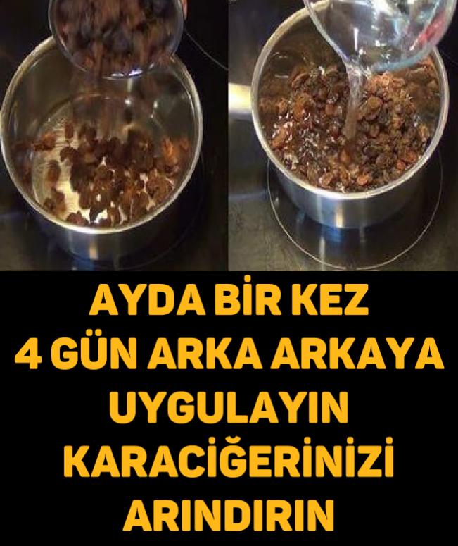 Ayda Bir Kez 4 Gün Arka arkaya Uygulayın Karaciğerinizi Arındırın