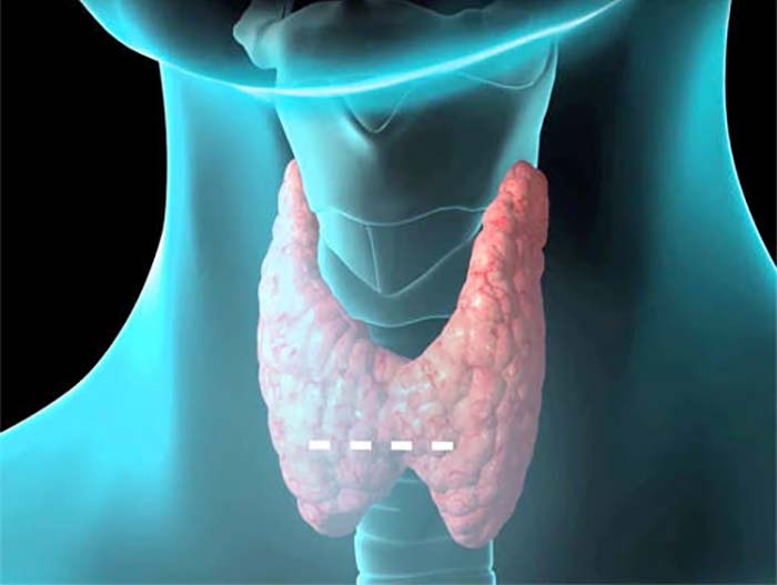 Tiroid Bezini Tedavi Eden Doğal İçecek Şişliklere ve Kilolara Veda Edin