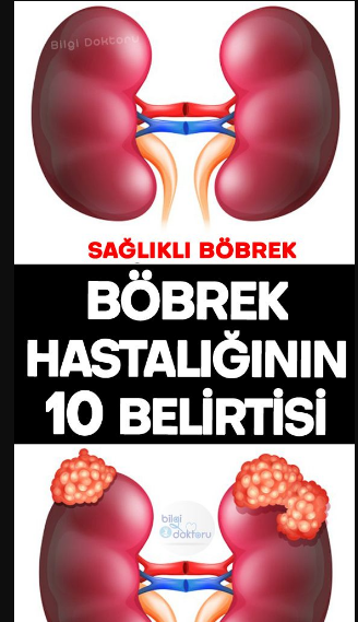 Böbrek hastalığının belirtileri