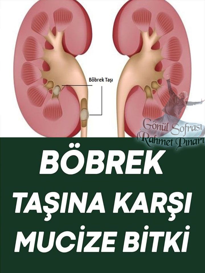 Böbrek Taşına Denenmiş Tarif