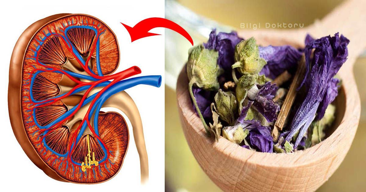Böbrek Taşına Denenmiş Tarif