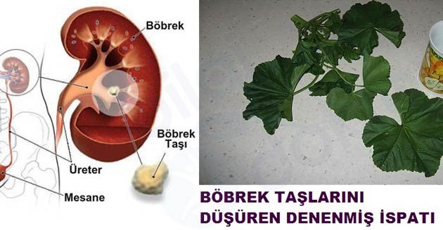 Böbrek Taşına Denenmiş Tarif
