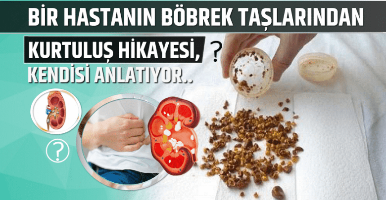 Böbrek Taşına Denenmiş Tarif