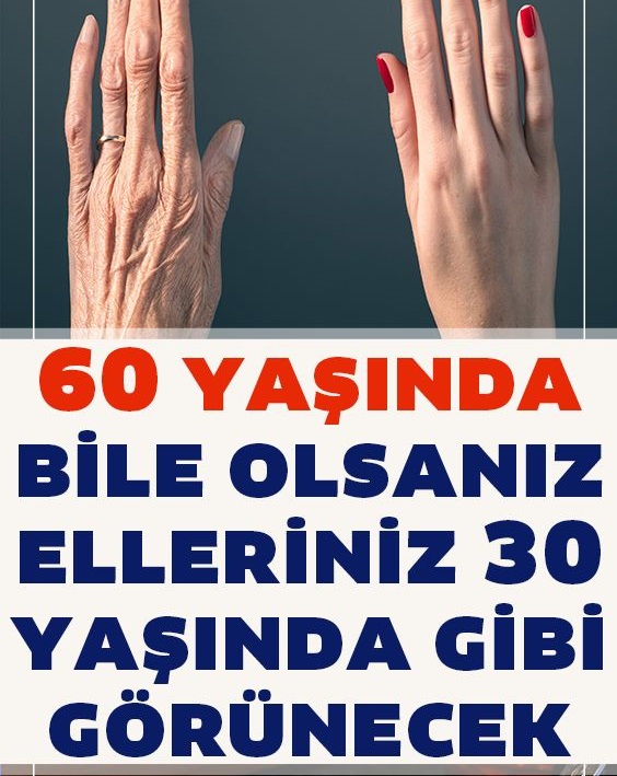 Eller Nasıl Gençleştirilir, 60 Yaşında Bile Olsanız Elleriniz 30 Yaşında Gibi Görünecek
