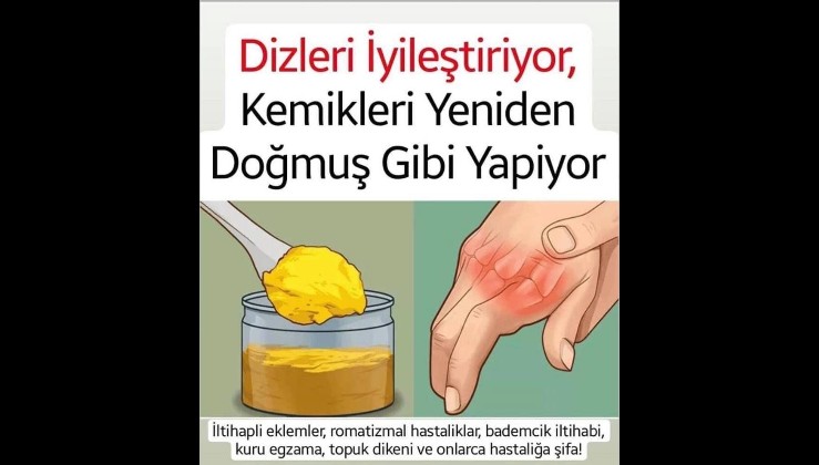 Dizleri iyileştiriyor! Kemikleri ve eklemleri yeniden doğmuş gibi yapıyor!