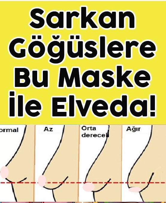 Gögüs Sarkmasını Önlemenin Etkili Yolu
