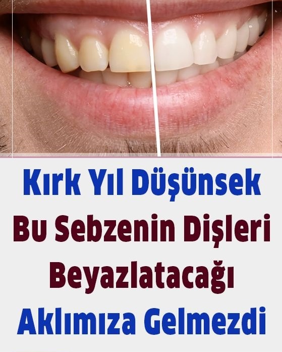 Kırk Sene Düşünsek Bu Sebzenin Dişleri Beyazlatacağı Usumuza Gelmezdi
