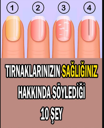 Tırnaklarımız sağlığımız hakkında ipuçları veriyor