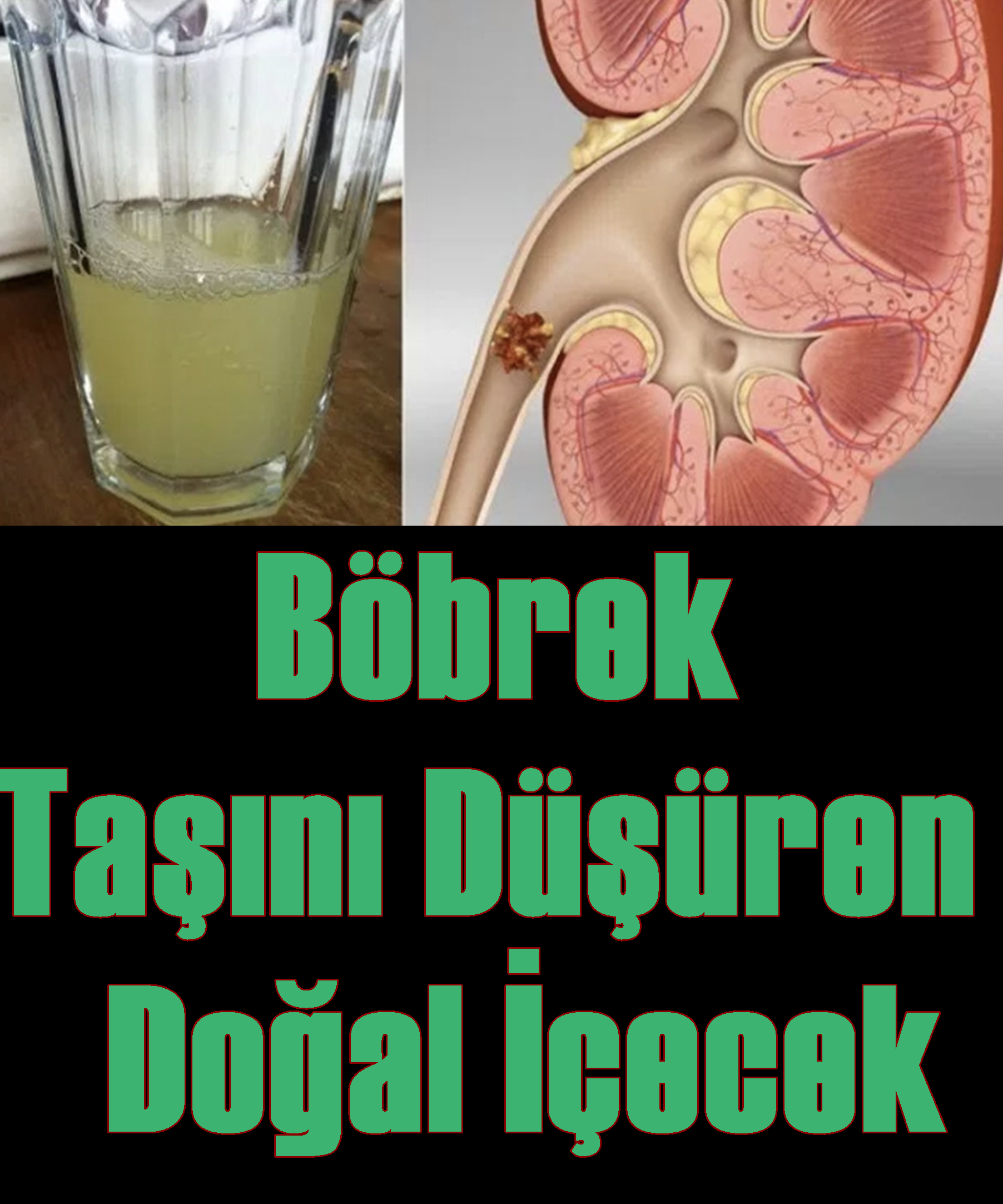 Böbrek Taşını Düşüren Doğal İçecek