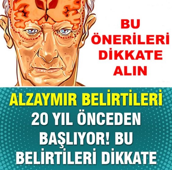 Alzheimer (Alzaymır) Belirtileri 20 Yıl Önceden Başlıyor