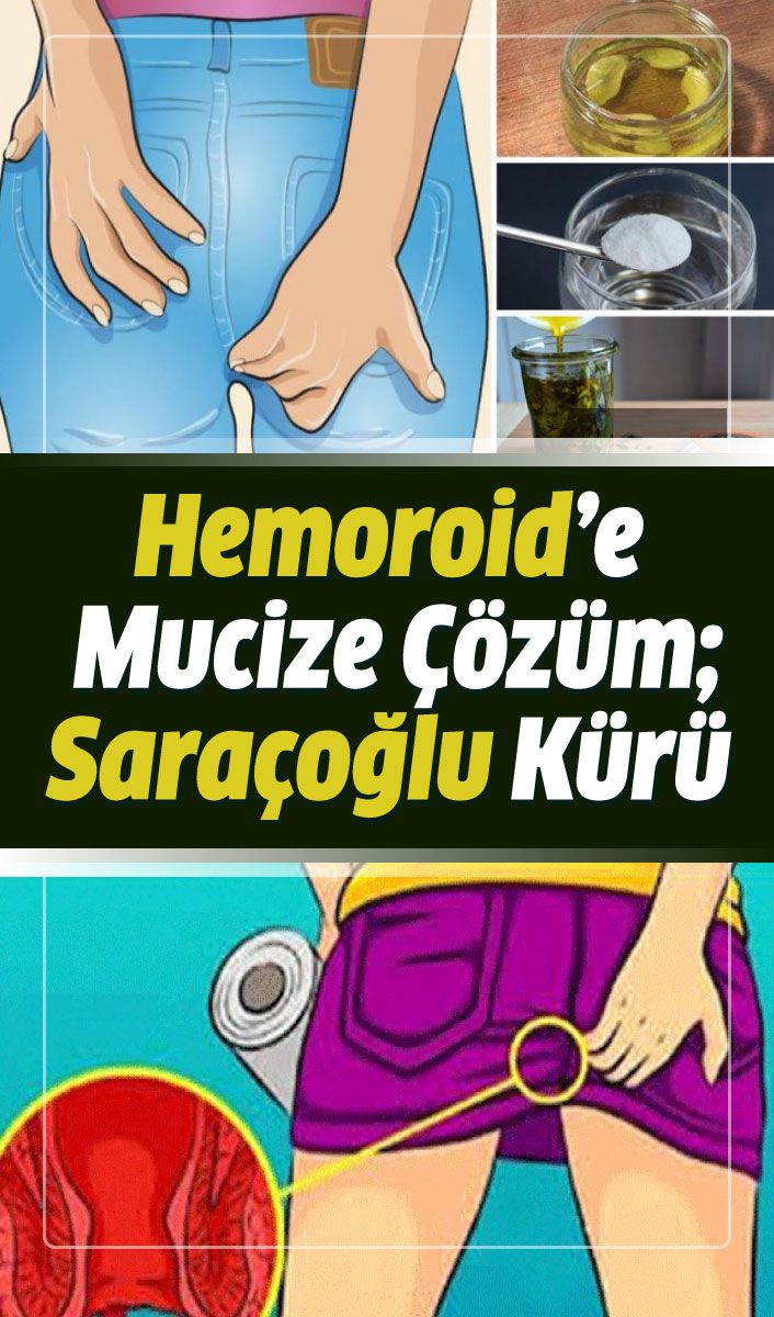 Basur hastalığının doğal çözümü