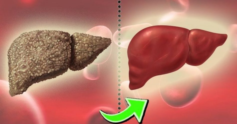 Karaciğer Yağlanması Belirtileri Ve Kür Tarifi