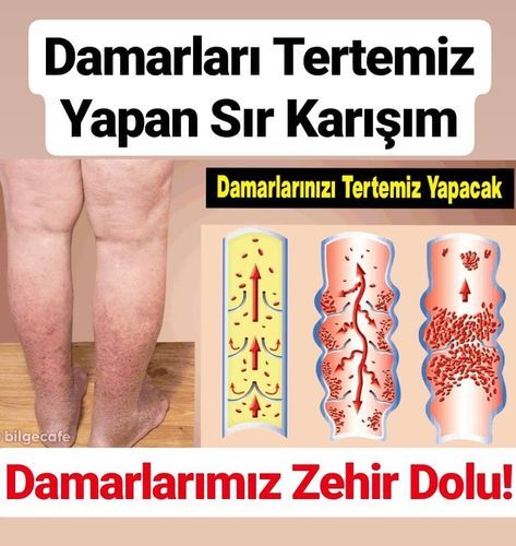 Maydanoz Suyu Faydaları? Ayrıntılı Maydanoz Kürü Tarifi