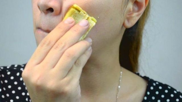 Sıradan 1 Muz Kabuğu İle Üstesinden Gelebileceğiniz 8 Sağlık Problemi