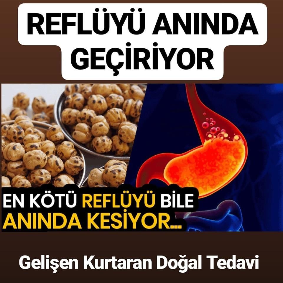 Reflüyü Anında Geçiren Doğal Tedavi