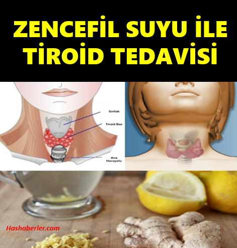 Tiroid Hastalığının Zencefil ile Çözümü