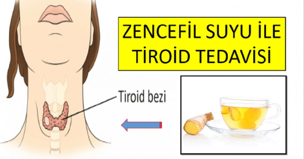 Tiroid Hastalığının Zencefil ile Çözümü
