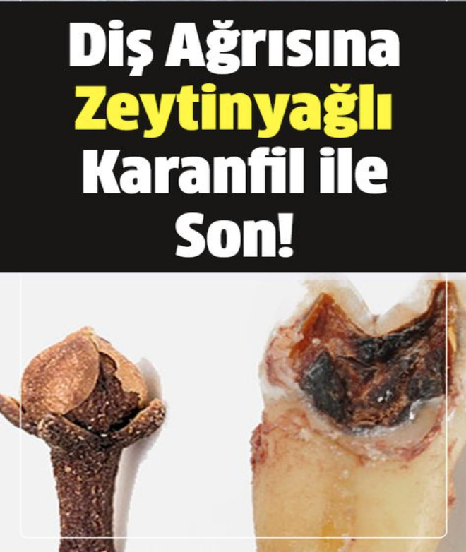 Diş Ağrısına Zeytinyağlı Karanfil ile Son