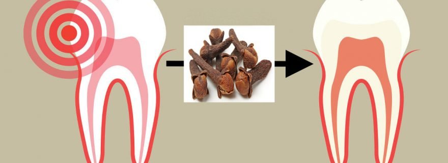 Diş Ağrısına Zeytinyağlı Karanfil ile Son