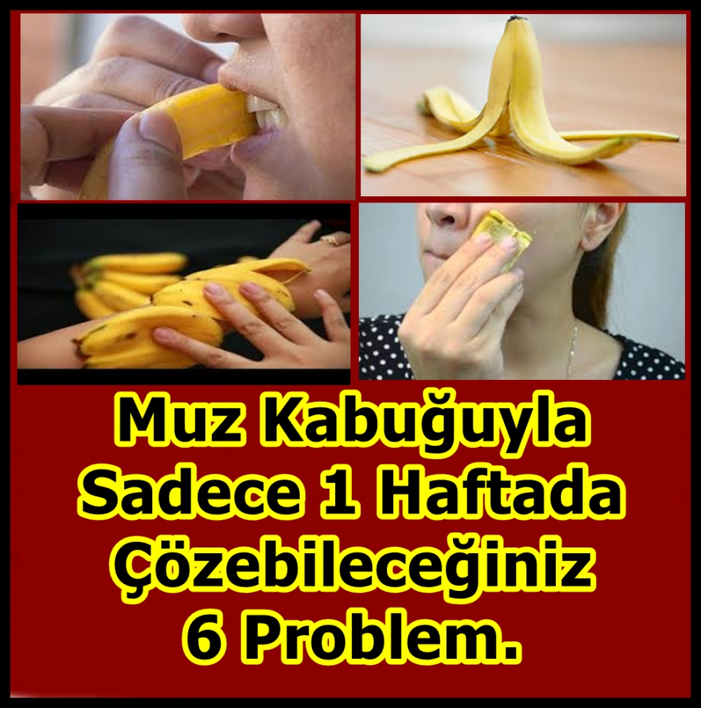 Muz Kabuğuyla Sadece 1 Haftada Çözebileceğiniz 6 Problem