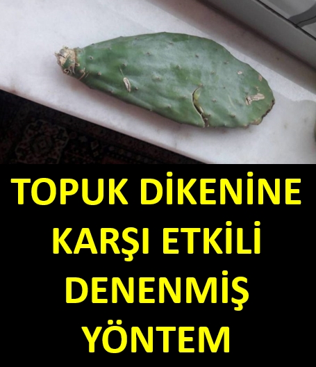 Topuk Dikeni Rahatsızlığına Karşı Doğal Yöntem