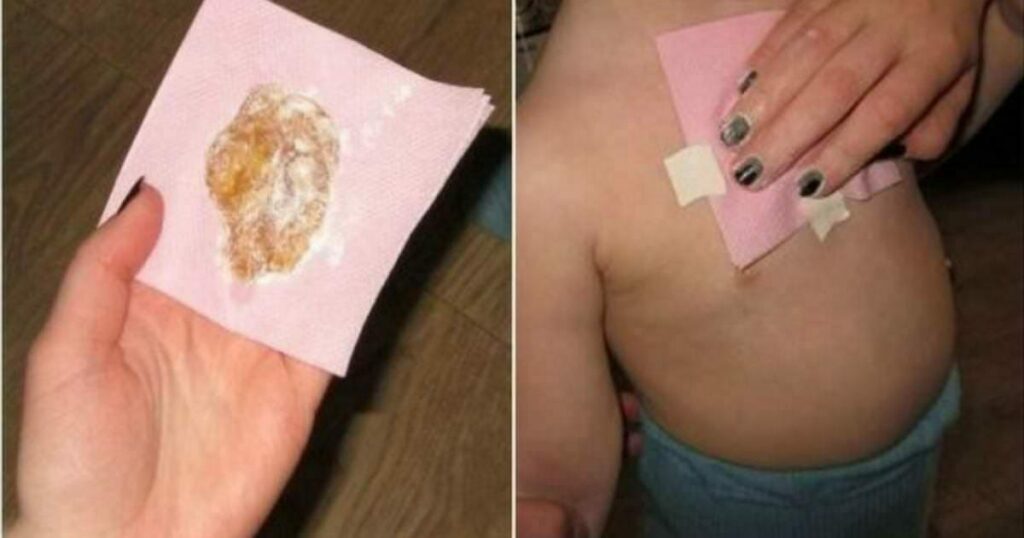 Öksürükten Bir Gecede Kurtulmanın Mucize Yolu