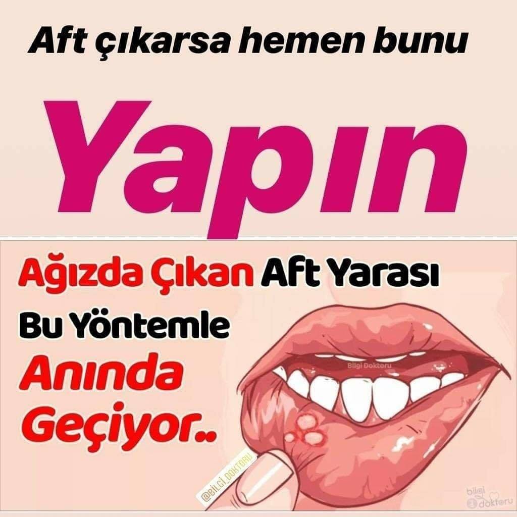 Aft Yarası Neden Çıkar, Kaç Günde Nasıl Geçer?