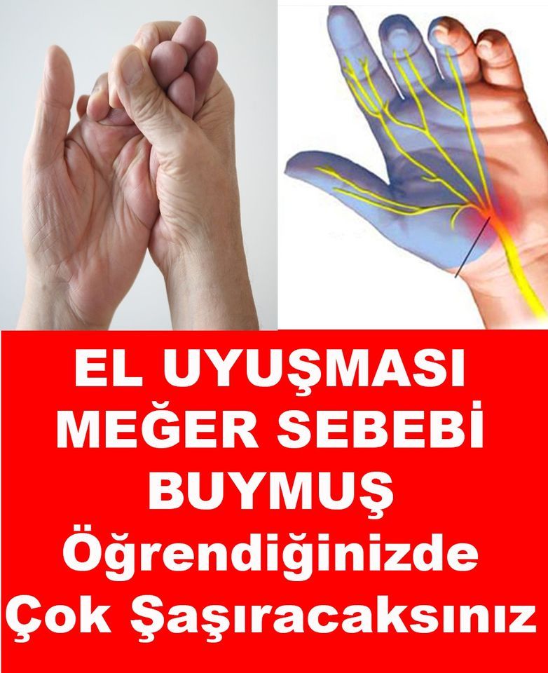 El Uyuşması Meğer Sebebi Buymuş