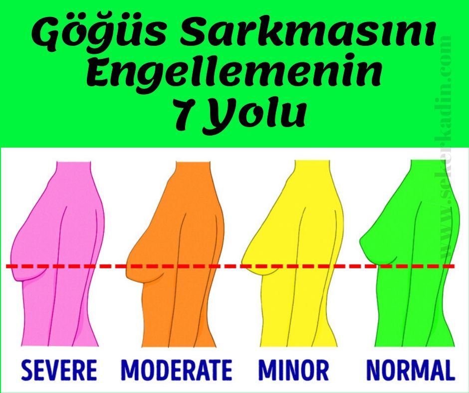 Göğüs Sarkmasını Engellemenin 7 Yolu