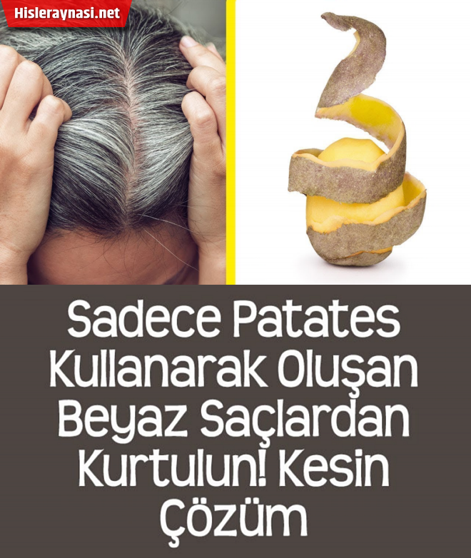 Patates ile saçlar
