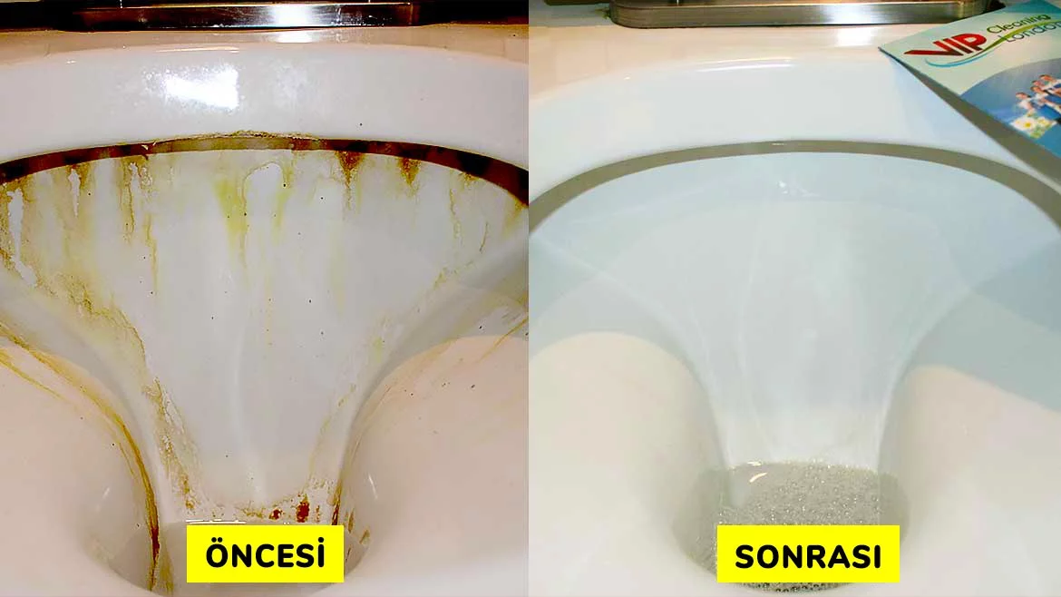 Klozetimdeki sarı lekelerden eser kalmadı