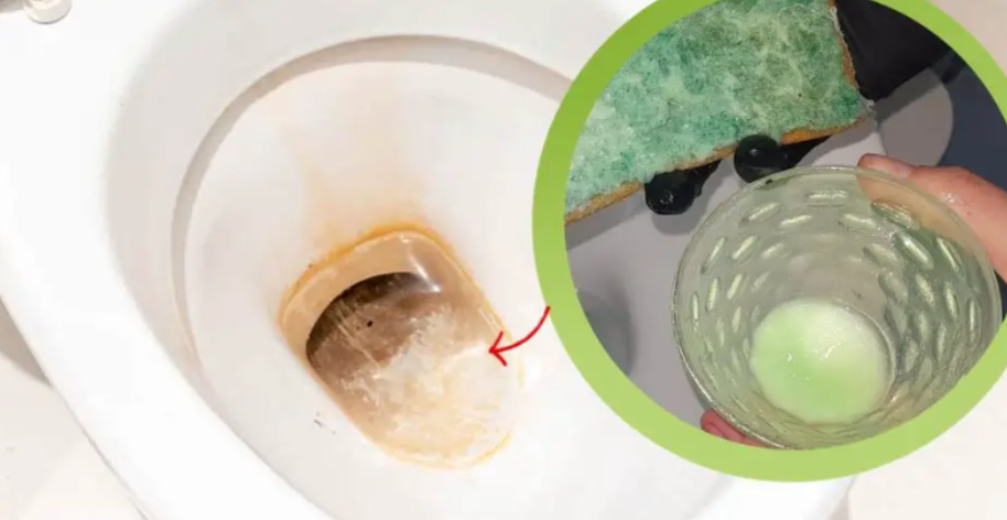 Tuvalette sarı çizgiler mi var?