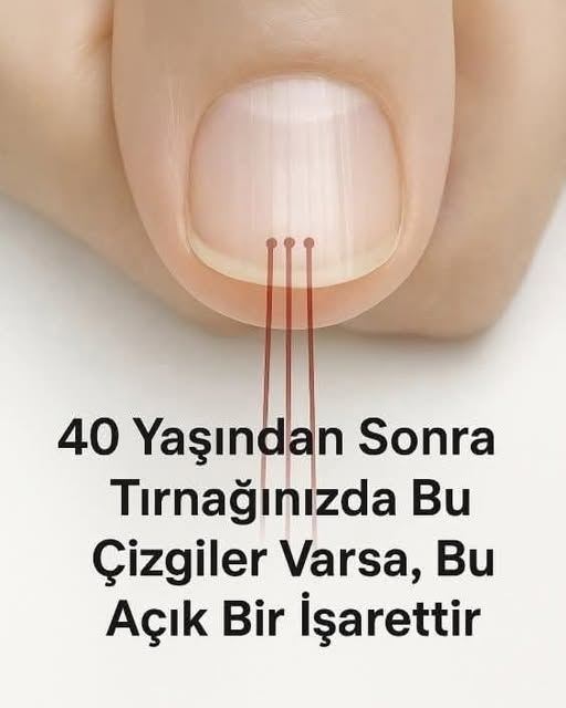 40 Yaşından Sonra Tırnağınızda Bu Çizgiler Varsa