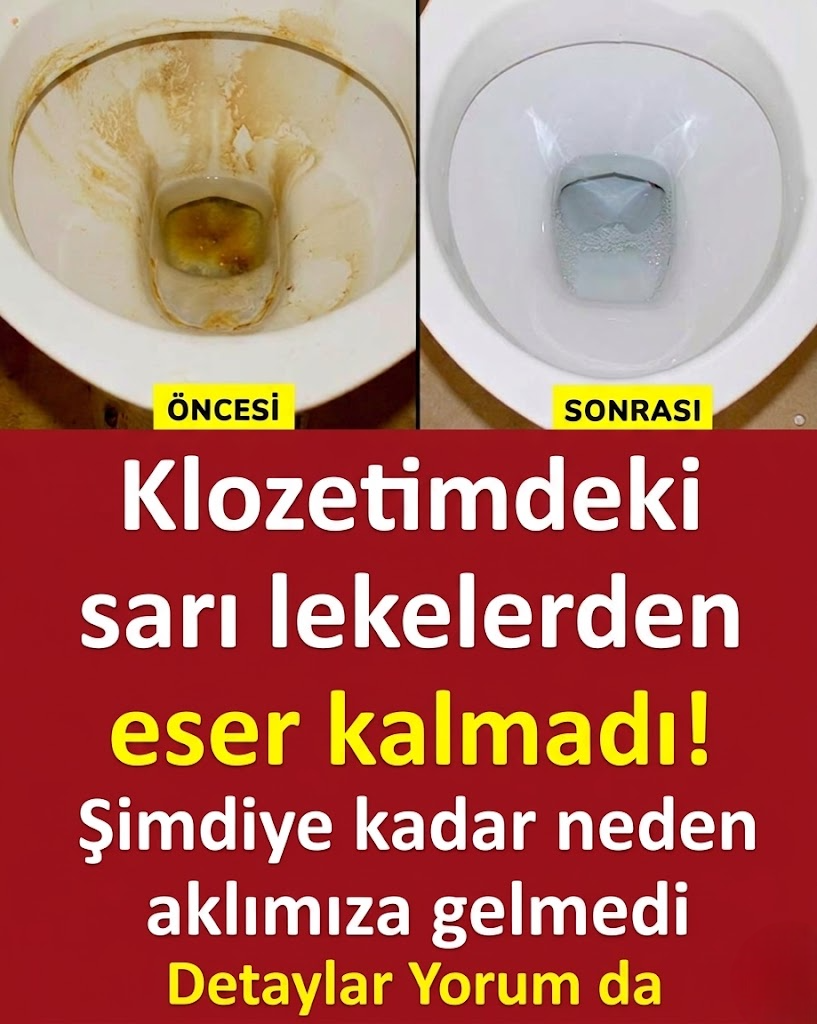 Klozetimdeki sarı lekelerden eser kalmadı