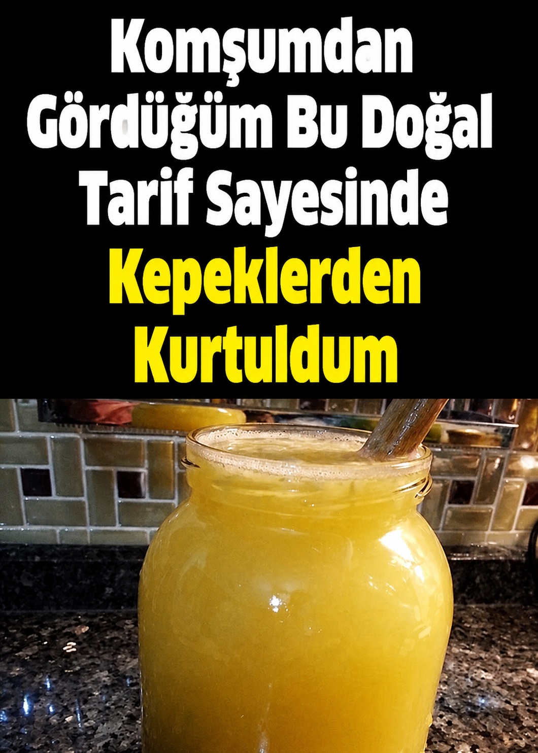 Komşumdan Öğrendiğim Doğal Tarif İle Kepek Sorununa Doğal Çözüm